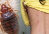 How to get rid of bed bugs
