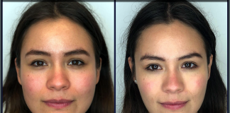 How to lose Face Fat?